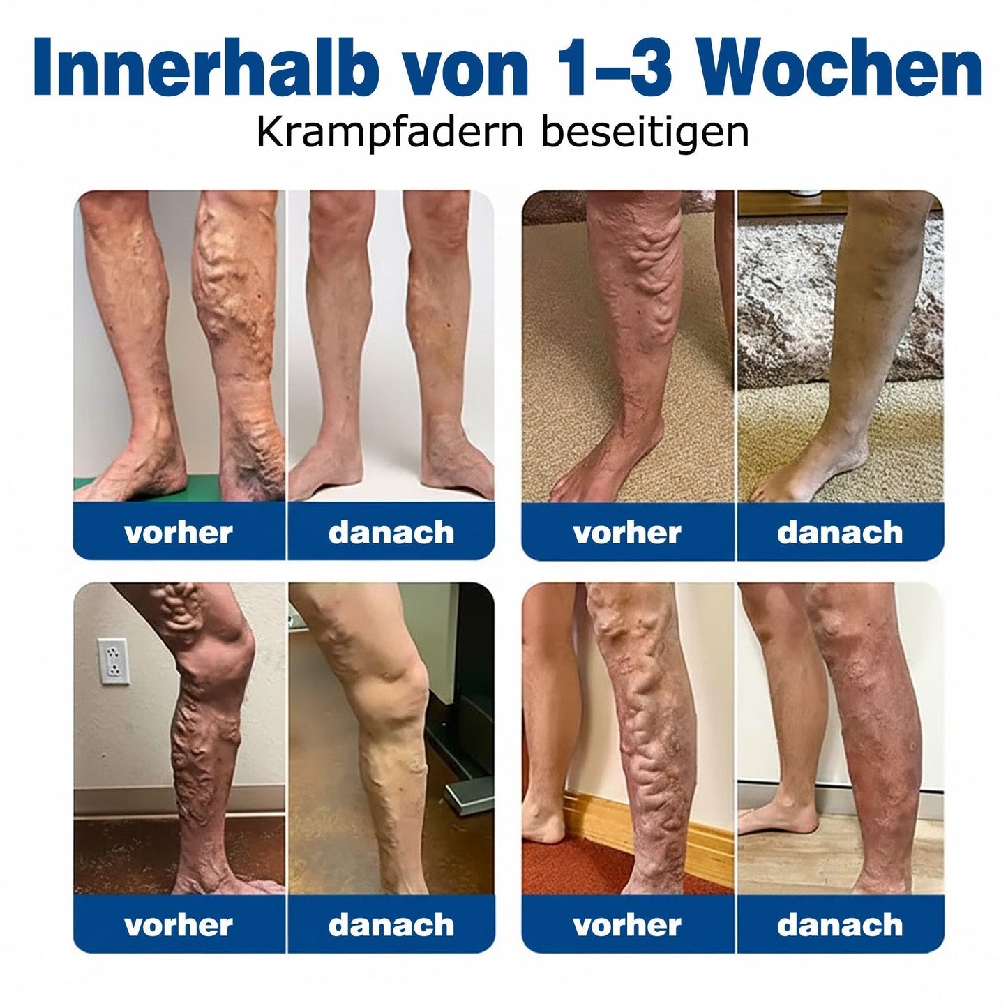 👨🏼‍⚕️✅GFOUK® VeinTarget Mikronadel-Pflaster⚡Sofortige Linderung, Langzeit-Ergebnisse