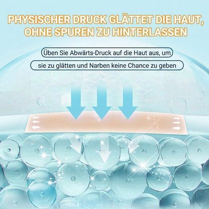 👨🏼‍⚕️✅Offizieller Shop | Ourlyard® Hyaluronsäure Mikronadel-Tape (Behandelt alle Arten von Narben, Dehnungsstreifen, Akne, Verbrennungen, Warzen und Krampfadern)