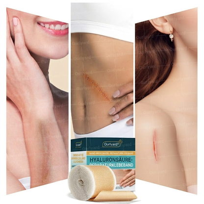 👨🏼‍⚕️✅Offizieller Shop | Ourlyard® Hyaluronsäure Mikronadel-Tape (Behandelt alle Arten von Narben, Dehnungsstreifen, Akne, Verbrennungen, Warzen und Krampfadern)