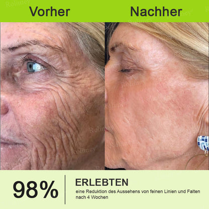 Rolimey® Retinol & Botox Shot: Die perfekte Ergänzung für Ihre Routine(upsell)