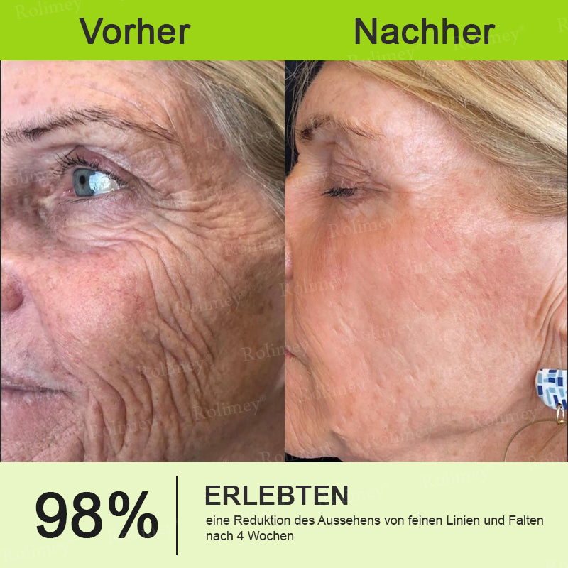 Rolimey® Retinol & Botox Shot (Straffende Gesichtscreme gegen Falten)