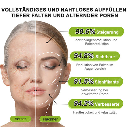 Rolimey® Retinol & Botox Shot (Straffende Gesichtscreme gegen Falten)