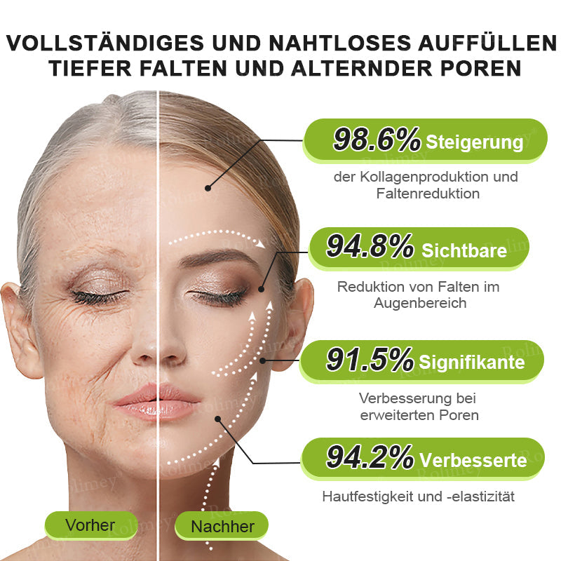 Rolimey® Retinol & Botox Shot: Die perfekte Ergänzung für Ihre Routine(upsell)