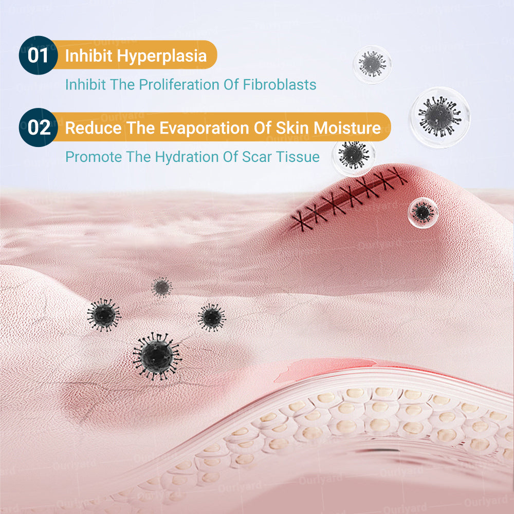 ❤︎Official Store |Ourlyard® Hyaluronsäure Nano Microneedle Repair Tape🗽🎉(Behandlung von alten und neuen Narben, Reduzierung von chirurgischen Narben, Dehnungsstreifen, Keloiden, Akne, Verbrennungen, Warzen, Dermatome und Krampfadern) (Upsell)