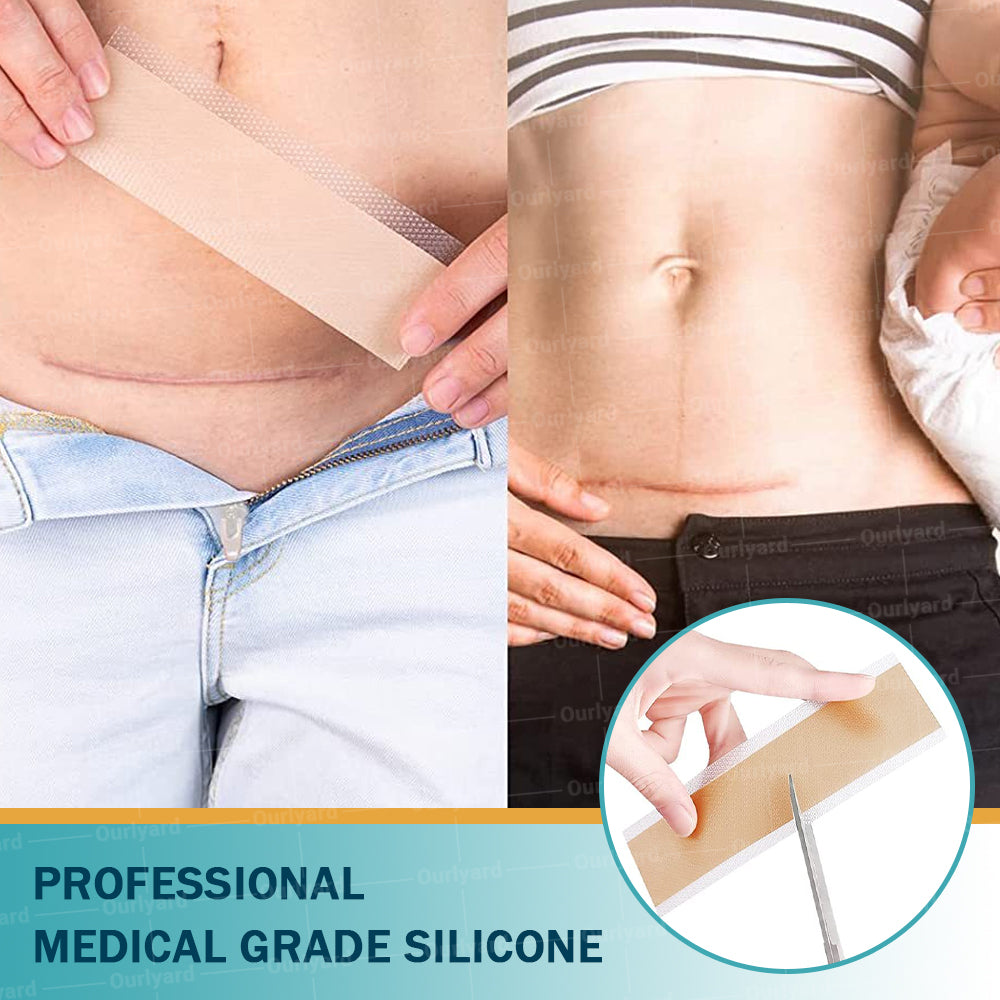 ❤︎Official Store |Ourlyard® Hyaluronsäure Nano Microneedle Repair Tape🗽🎉(Behandlung von alten und neuen Narben, Reduzierung von chirurgischen Narben, Dehnungsstreifen, Keloiden, Akne, Verbrennungen, Warzen, Dermatome und Krampfadern) (Upsell)