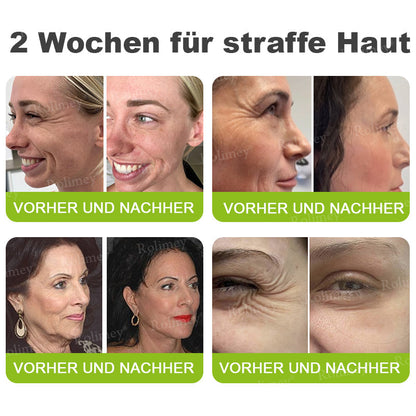 Rolimey® Retinol & Botox Shot (Straffende Gesichtscreme gegen Falten)