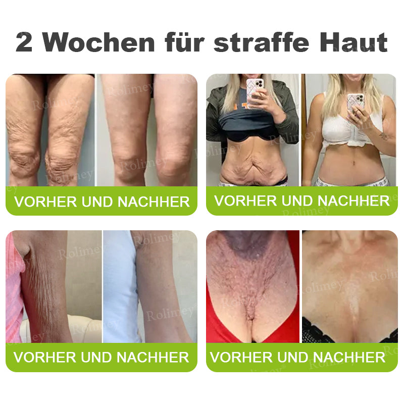Rolimey® Retinol & Botox Shot (Straffende Gesichtscreme gegen Falten)
