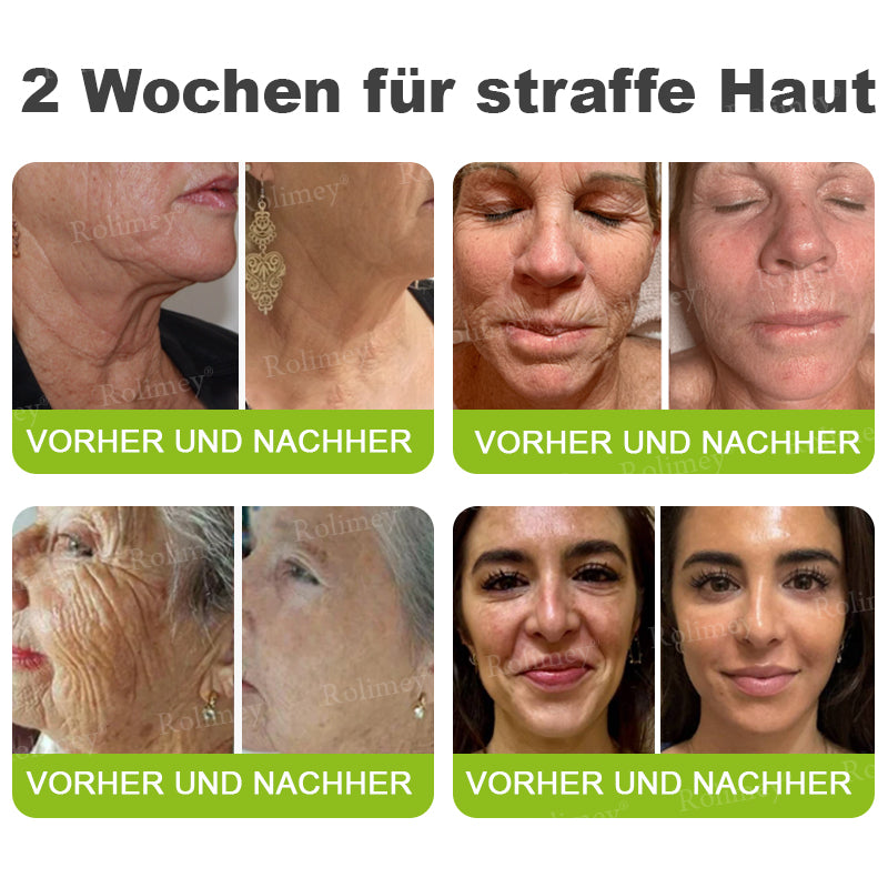 Rolimey® Retinol & Botox Shot (Straffende Gesichtscreme gegen Falten)