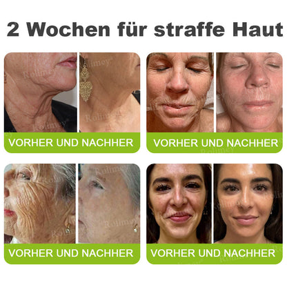 Rolimey® Retinol & Botox Shot: Die perfekte Ergänzung für Ihre Routine(upsell)